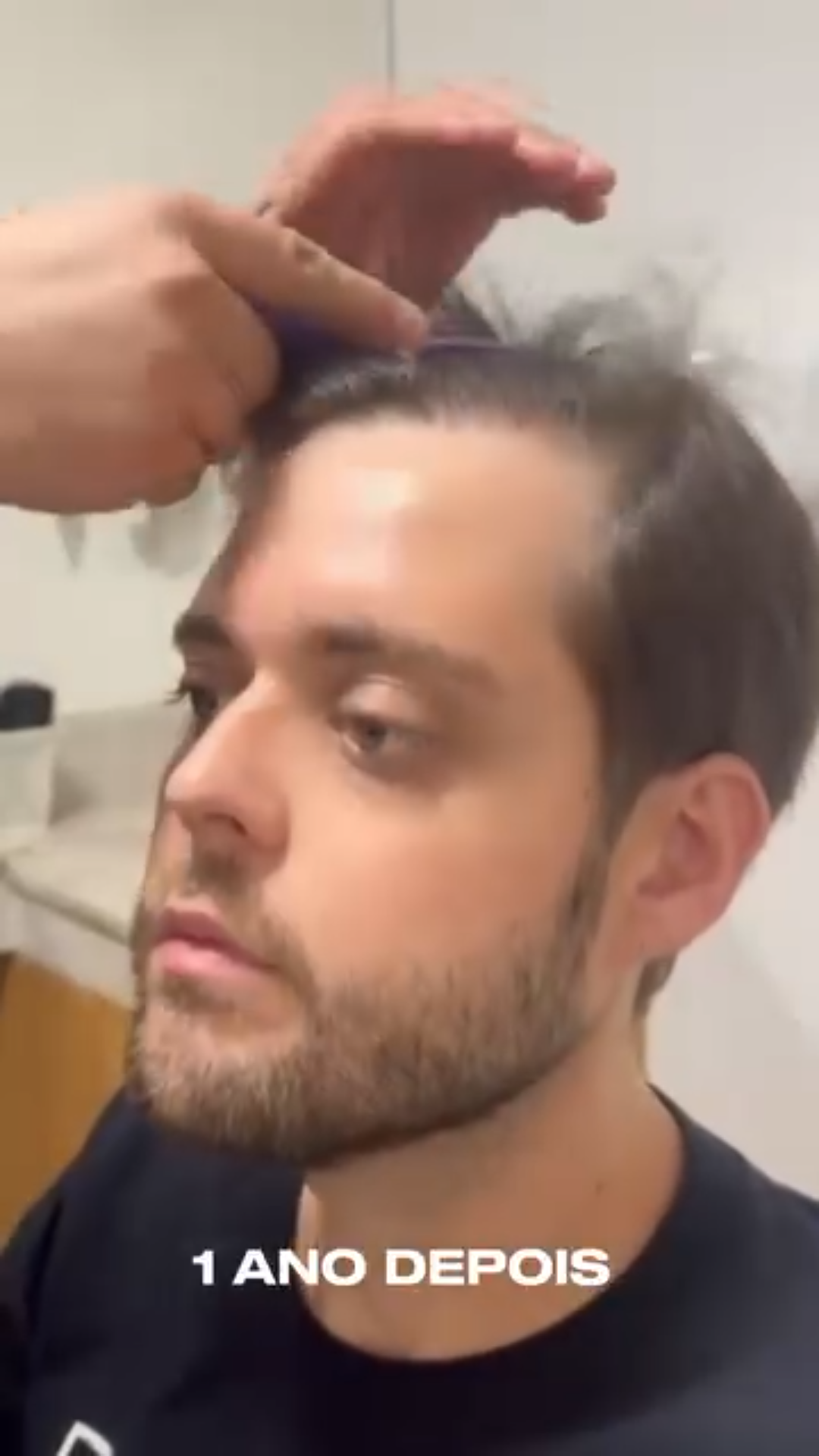 uploads/frames pro hair(2).png